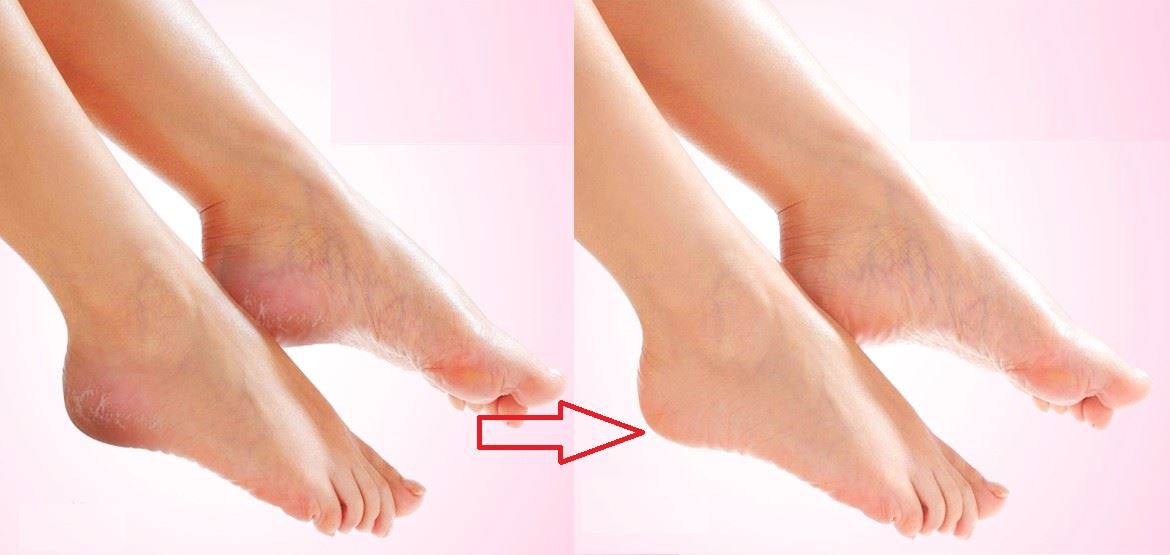 feet peeling mask feet peeling mask