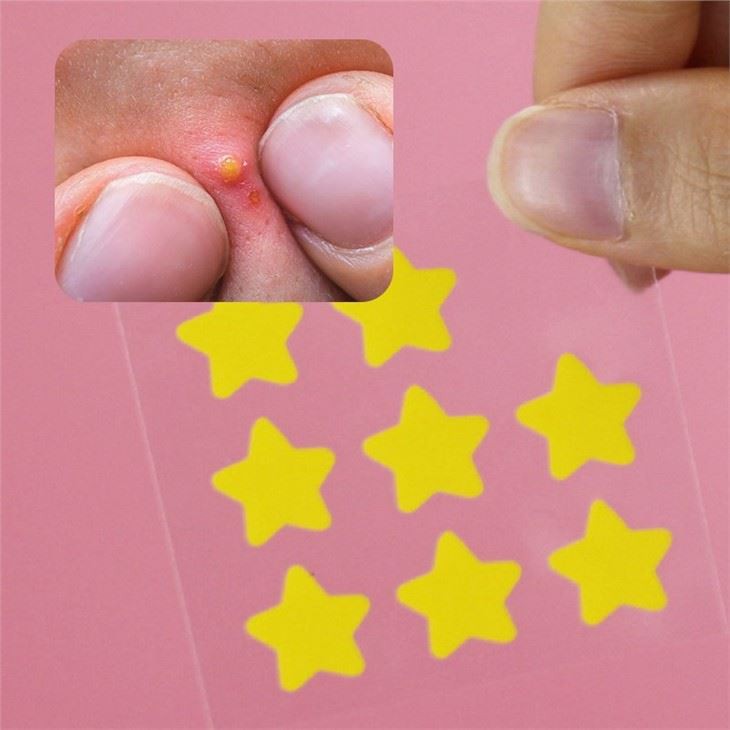star acne patches